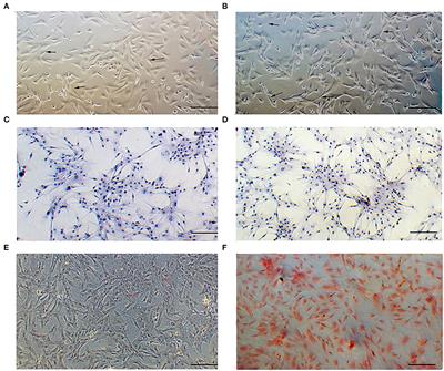 A genome-wide integrated analysis of lncRNA-mRNA in melanocytes from white and brown skin hair boer goats (Capra aegagrus hircus)